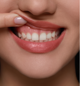 Non-Invasive Gum Surgery